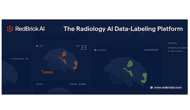 RedBrick AI Raises US$4.6M To Accelerate The Development Of Healthcare AI